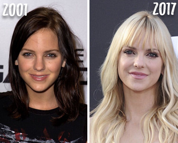 Anna Faris Before And After Plastic Surgery 1