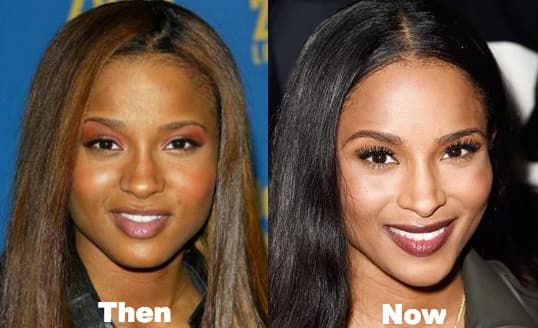Ciara Before And After Plastic Surgery 1