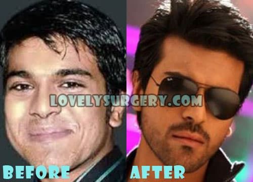 Ram Charan Before Plastic Surgery 1