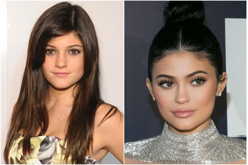 The Kardashians Before And After Plastic Surgery 1
