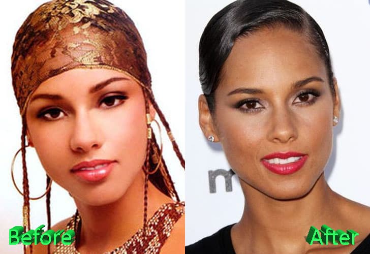 Alicia Keys Before And After Plastic Surgery 1