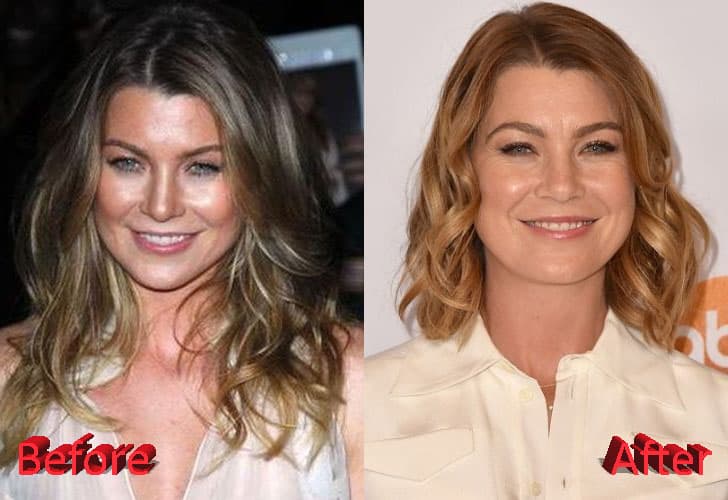 Ellen Pompeo Plastic Surgery Before And After 1