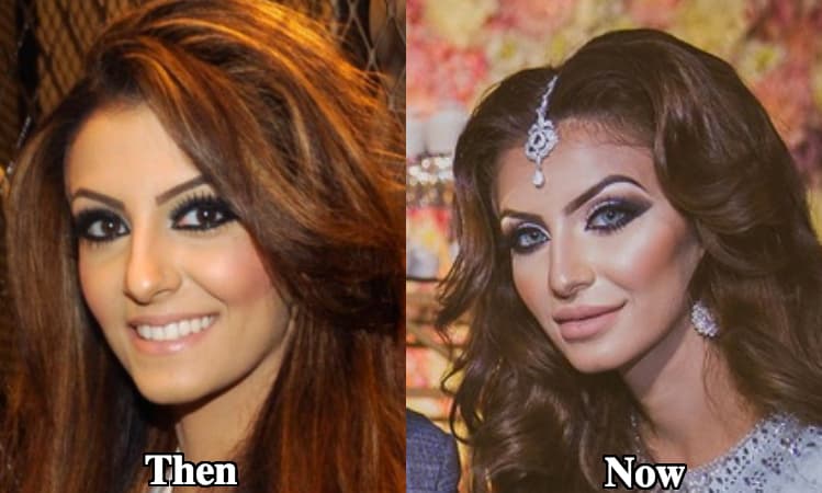 Faryal Makhdoom Before Plastic Surgery And After 1