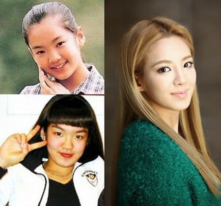 Girl Generation Surgery Plastic Before And After 1