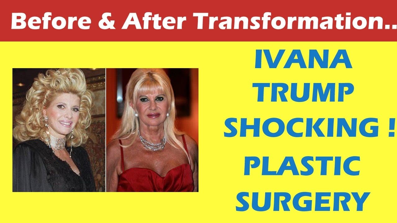 Ivana Trump Plastic Surgery Before And After 1