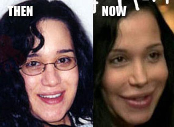 Janeane Garofalo Plastic Surgery Before And After 1