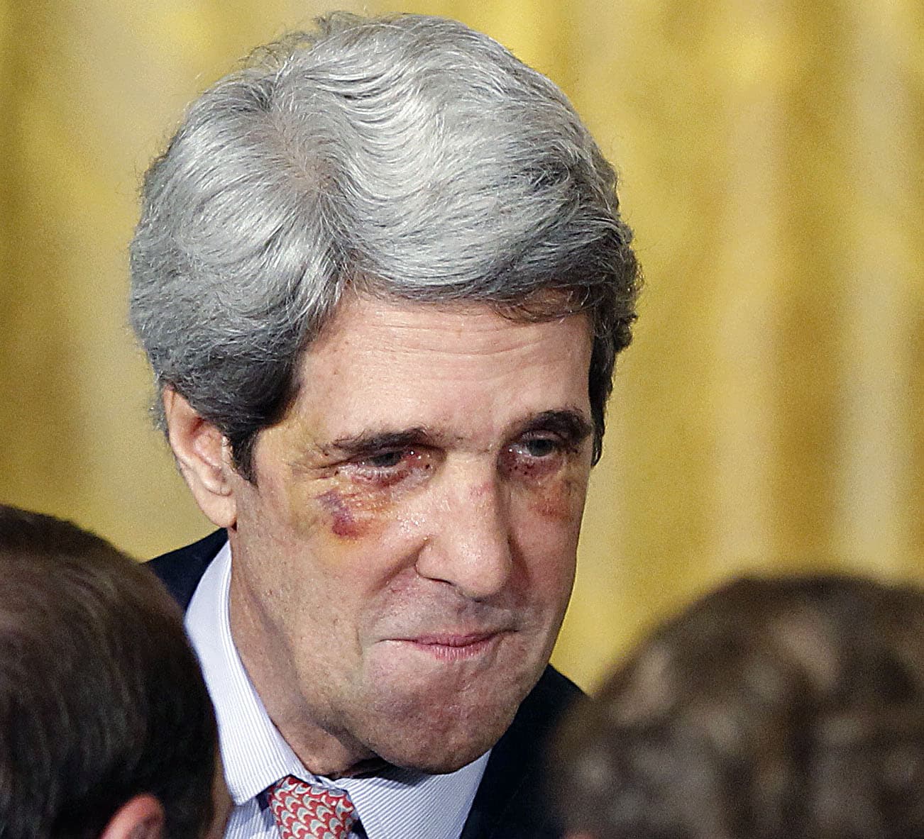 John Kerry Before Plastic Surgery 1