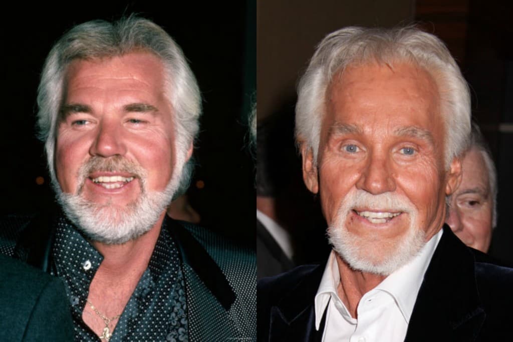Kenny Rogers Before Plastic Surgery 1