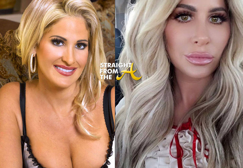 Kim Zolciak Plastic Surgery Before And After Face 1