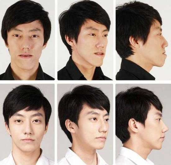 Koreans Before Plastic Surgery 1
