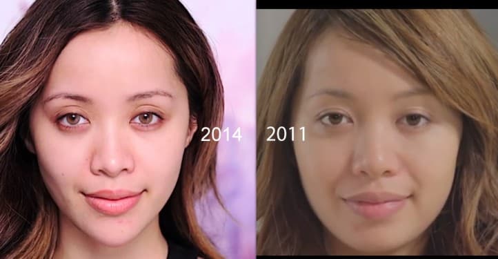 Michelle Phan Before Plastic Surgery 1