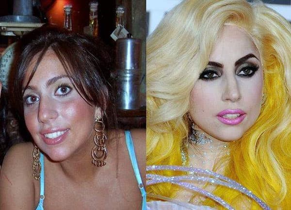 Miley Cyrus Plastic Surgery Before And After Photos 1