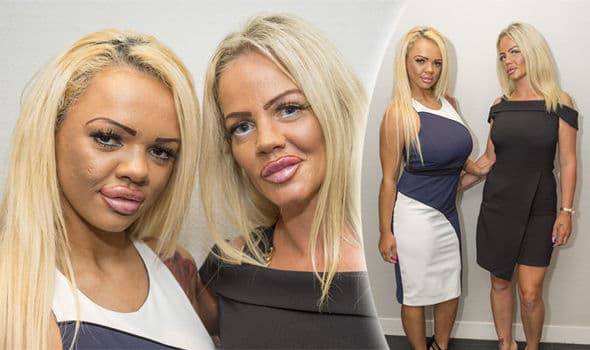 Mother Daughter Plastic Surgery Before And After 1