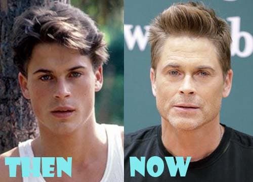 Rob Lowe Plastic Surgery Before And After 1