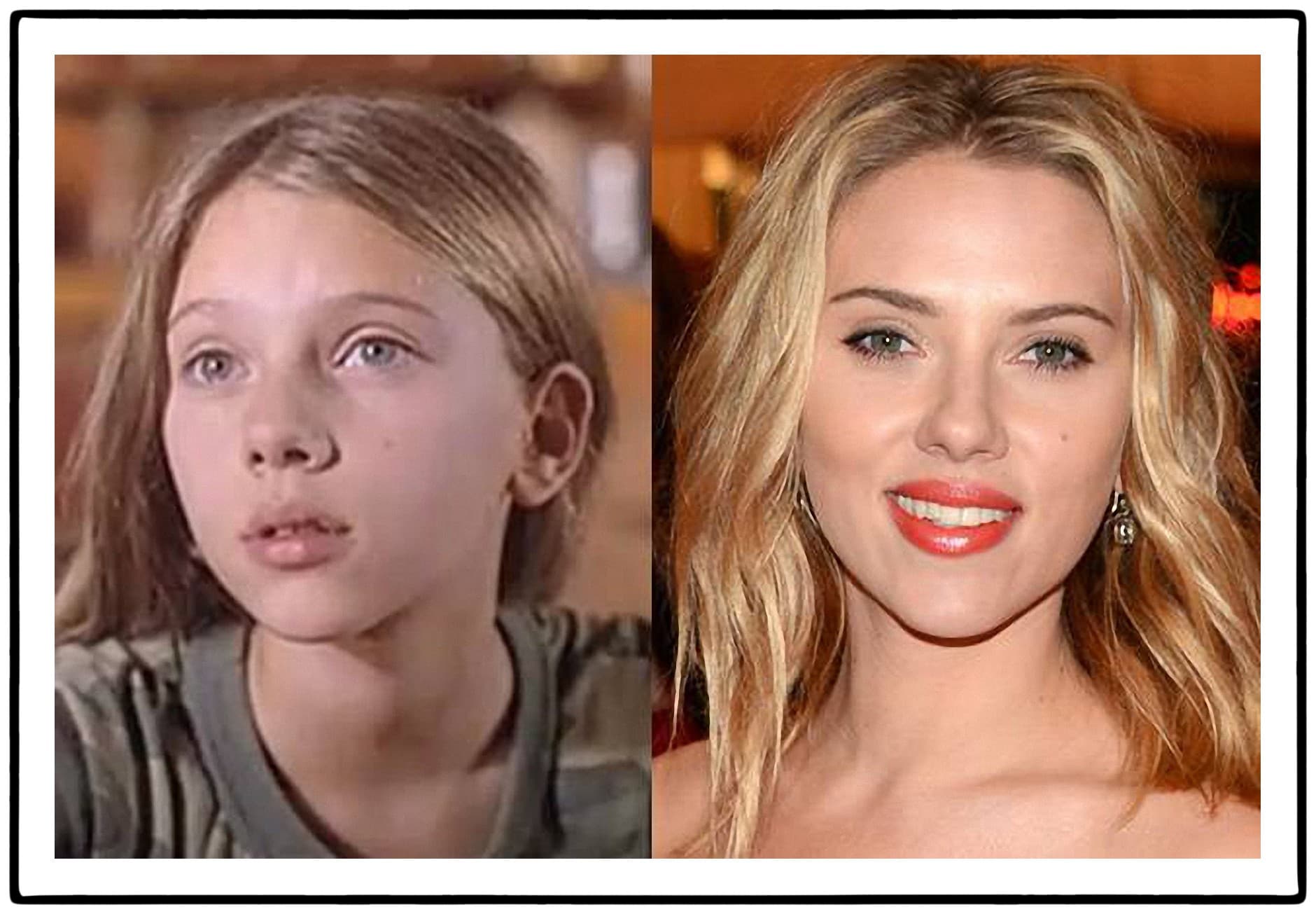 Scarlett Johansson Before And After Plastic Surgery 1