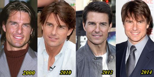 Tom Cruise Plastic Surgery Pictures Before And After 1