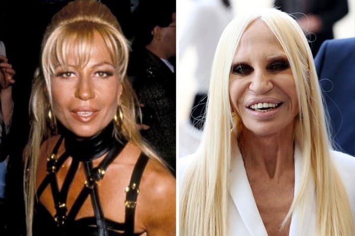 Versace Donatella Before Plastic Surgery 1