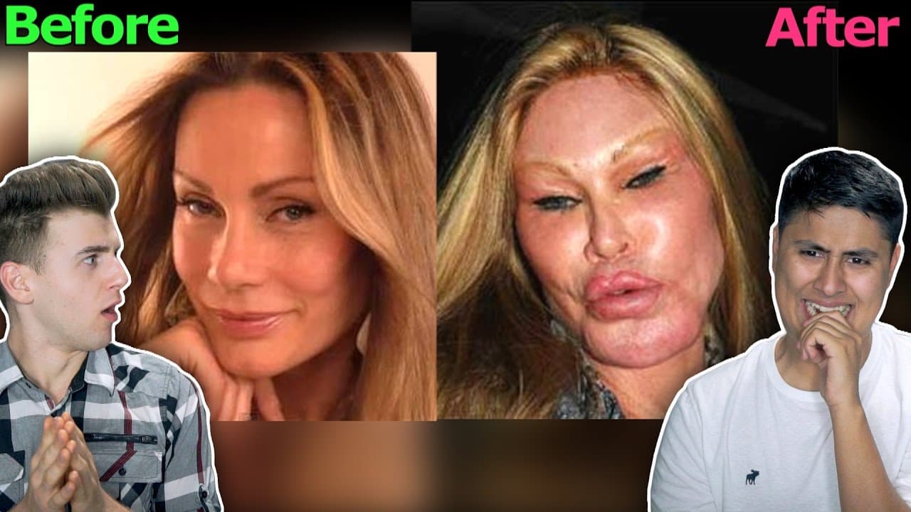 Before And After Plastic Surgery Fail 1