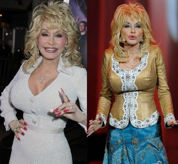 Dolly Parton Before Then Breast And Now Plastic Surgery 1
