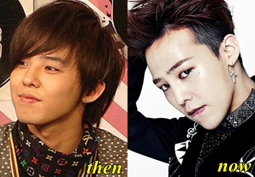 Gdragon Before And After Plastic Surgery 1
