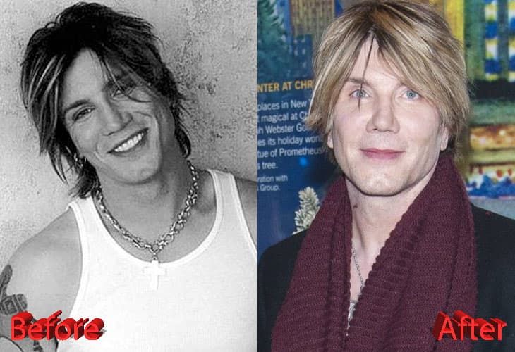 Goo Goo Dolls Singer Plastic Surgery Before And After 1