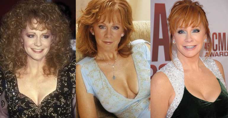 Linda Thompson Before And After Plastic Surgery 1