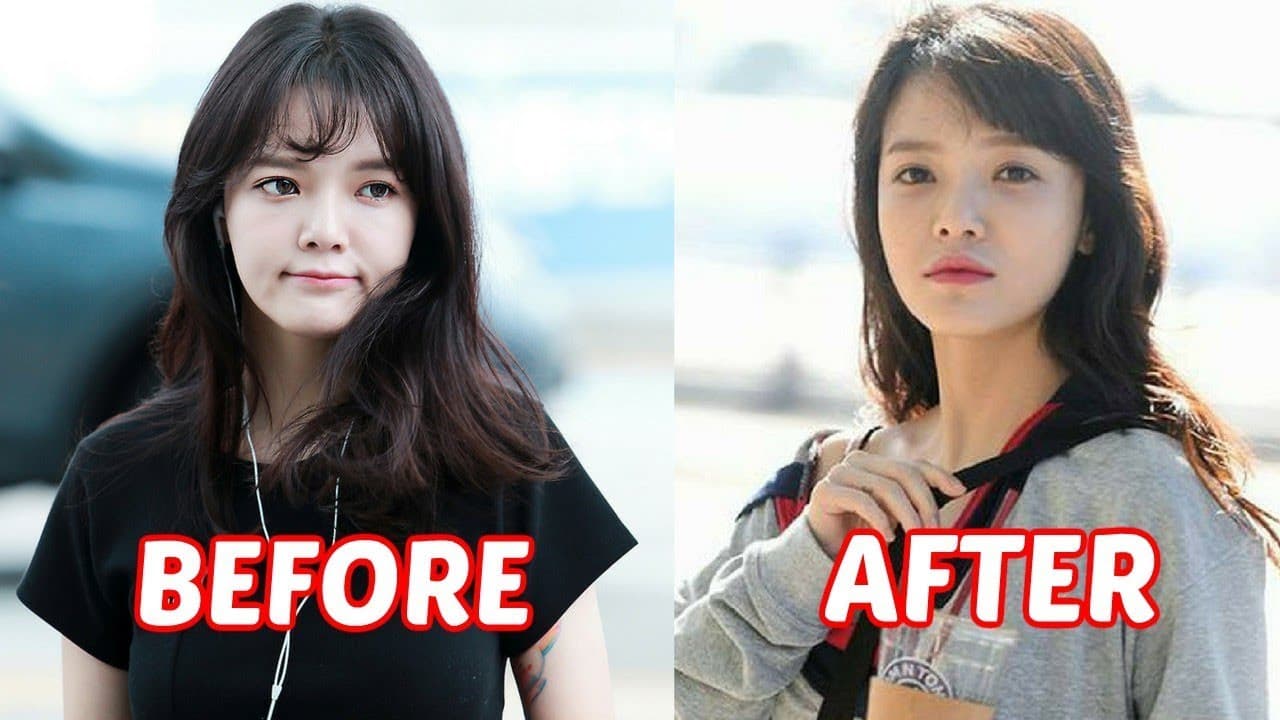 Plastic Surgery Before And After Youtube 1