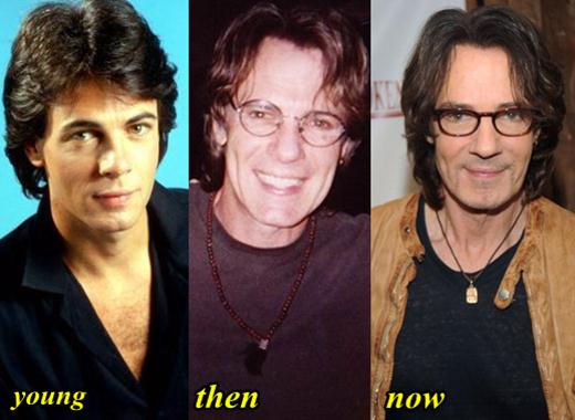 Rick Springfield Plastic Surgery Before And After 1