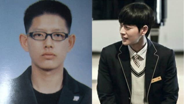 Running Man Plastic Surgery Before After 1