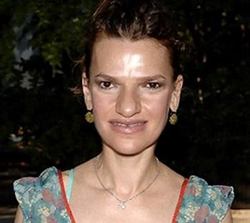 Sandra Bernhard Plastic Surgery Before And After 1