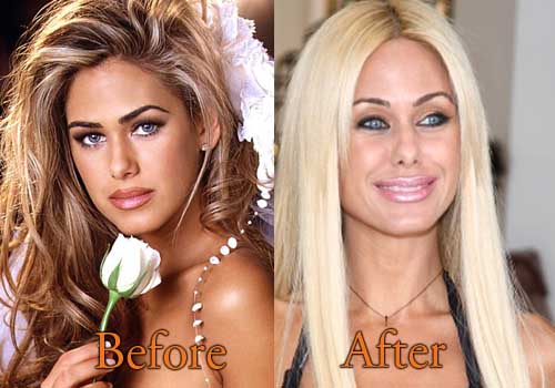 Shauna Sand Before And After Plastic Surgery 1
