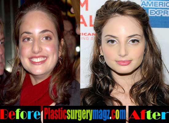 Alexa Ray Joel Before And After Plastic Surgery 1