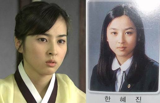 Before And After Plastic Surgery Korean Drama Wiki 1