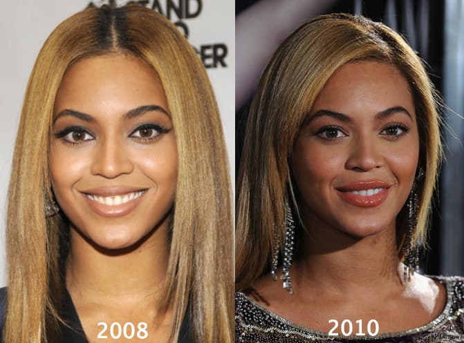 Beyonce Before And After Plastic Surgery Pictures 1