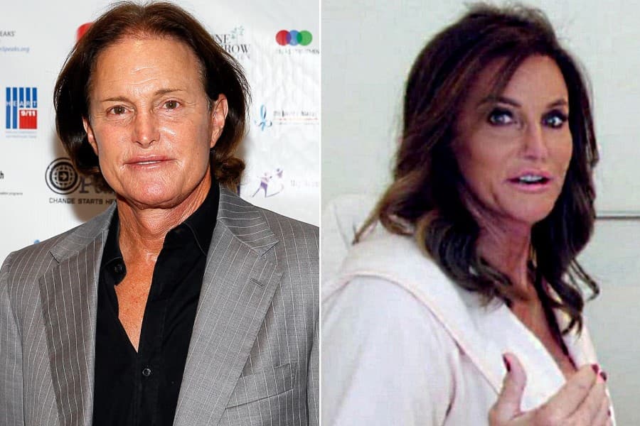 Bruce Jenner Plastic Surgery Caitlin Before And After 1