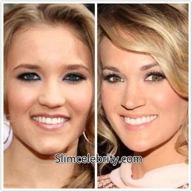 Carrie Underwood Before And After Face Plastic Surgery 1
