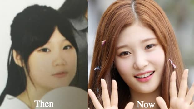 Chae Jung Ahn Before Plastic Surgery 1
