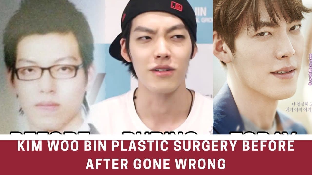 Dong Wook Before Plastic Surgery 1