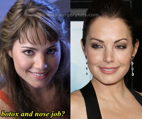 Erica Durance Before And After Plastic Surgery 1