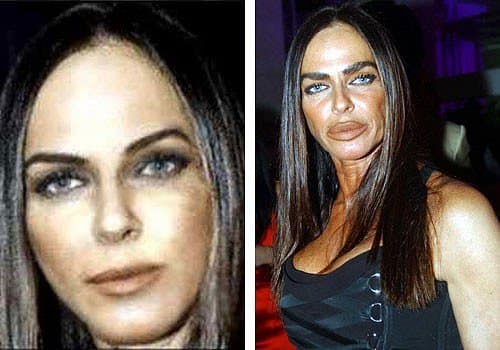 French Artists Before And After Plastic Surgery 1