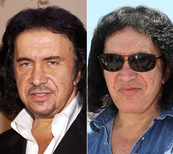 Gene Simmons Before And After Plastic Surgery 1