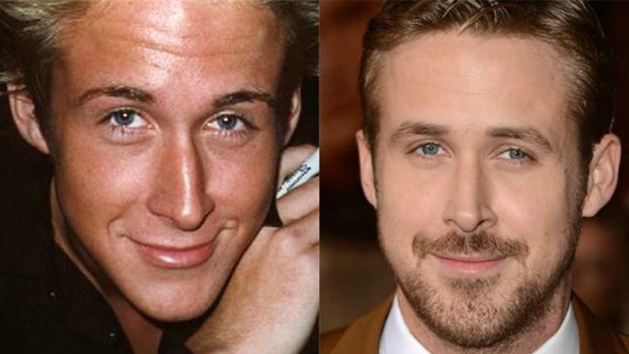 Hollywood Men Plastic Surgery Before And After 1