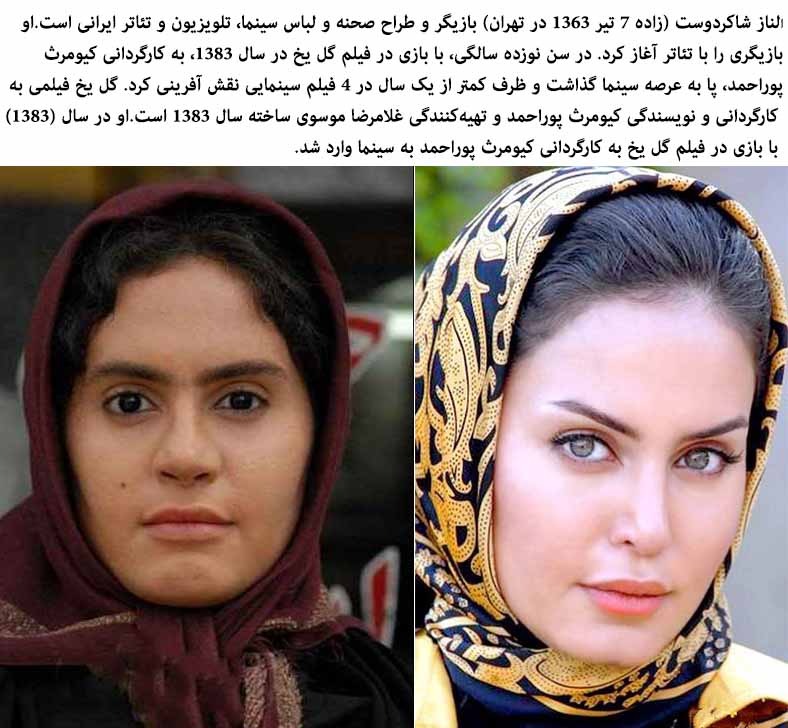 Iranian Woman With Plastic Surgery Before And After Pictures 1