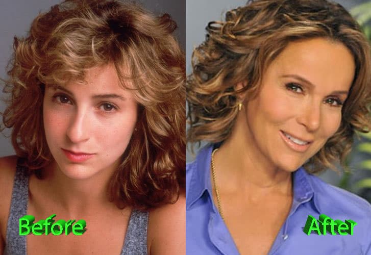 Jennifer Grey Plastic Surgery Before And After 1