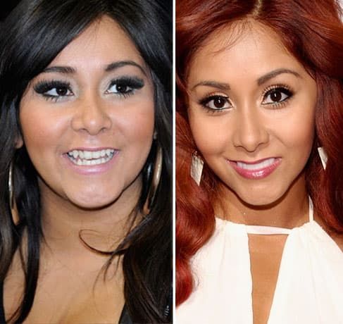 Jersey Shore Cast Before And After Plastic Surgery 1