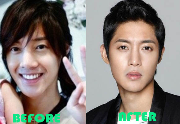 Kim Hyun Joong Before Plastic Surgery 1