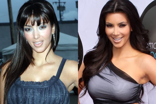 Kim Kardashian Before And After Plastic Surgery Pictures 1