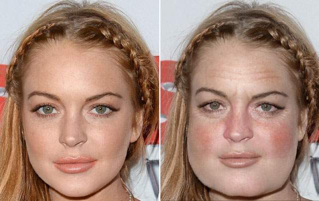 Lindsay Lohan Before And After Plastic Surgery 2013 1