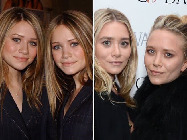 Mary Kate And Ashley Olsen Plastic Surgery Before After 1
