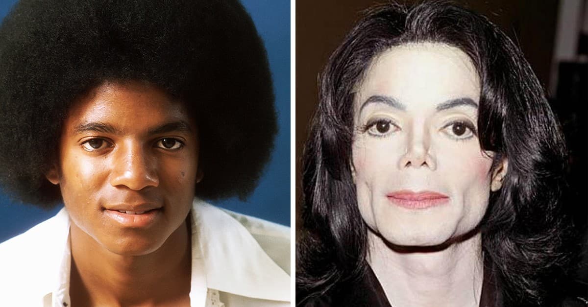 Micheal Jackson Before And After Plastic Surgery 1